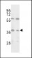 Isocitrate dehydrogenase (IDH3) Antibody (C-term)